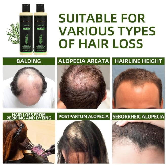 š± Organic Rosemary Hair Growth Shampoo