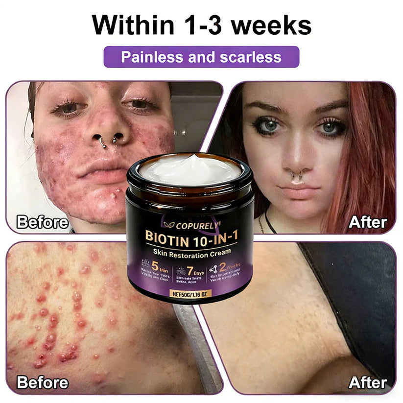 🔥LAST DAY 50% OFF - COPURELY® Biotin 10-in-1 Skin Restoration Cream