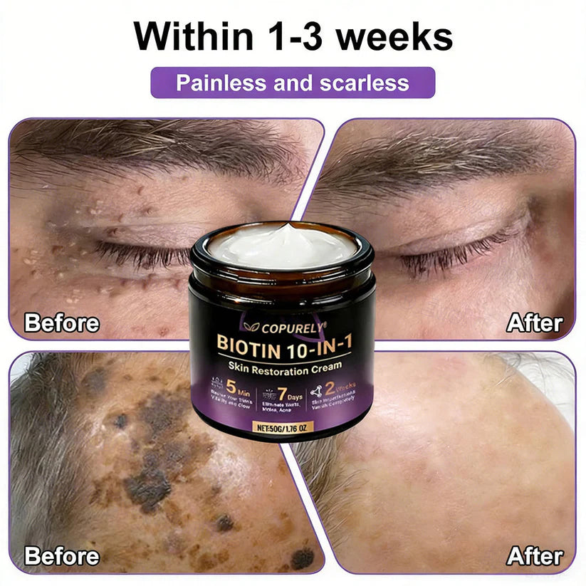 🔥LAST DAY 50% OFF - COPURELY® Biotin 10-in-1 Skin Restoration Cream