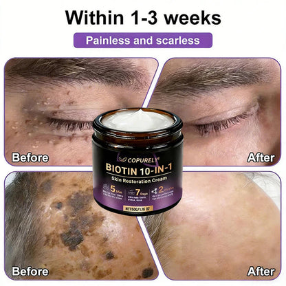 🔥LAST DAY 50% OFF - COPURELY® Biotin 10-in-1 Skin Restoration Cream