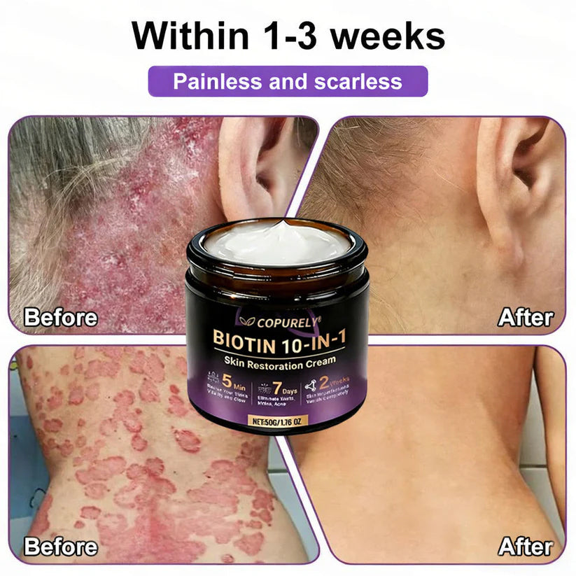 🔥LAST DAY 50% OFF - COPURELY® Biotin 10-in-1 Skin Restoration Cream