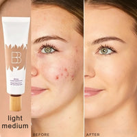 LIGHT-MEDIUM