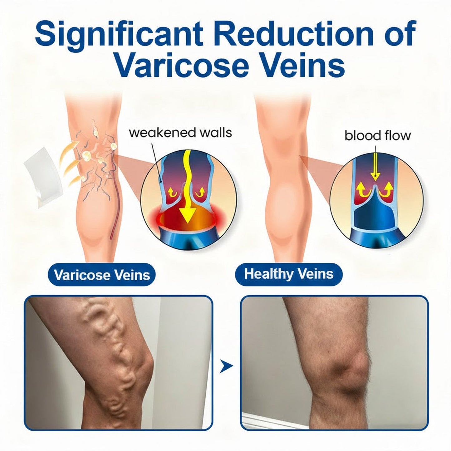 🇺🇸👨‍⚕️🔥COPURELY® VeinEase Microneedle Care Patch⚡Instant Relief, Long-Term Results