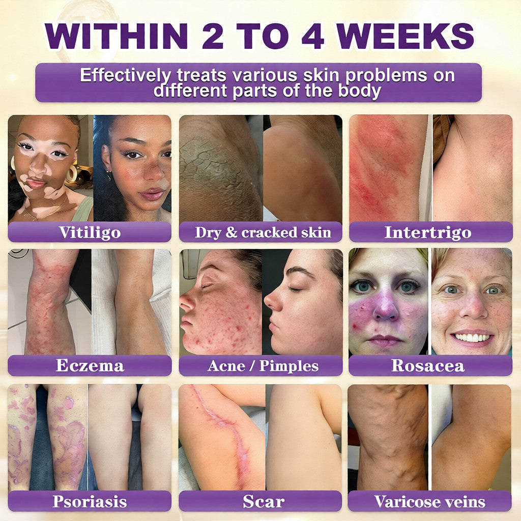 🔥LAST DAY 50% OFF - COPURELY® Biotin 10-in-1 Skin Restoration Cream