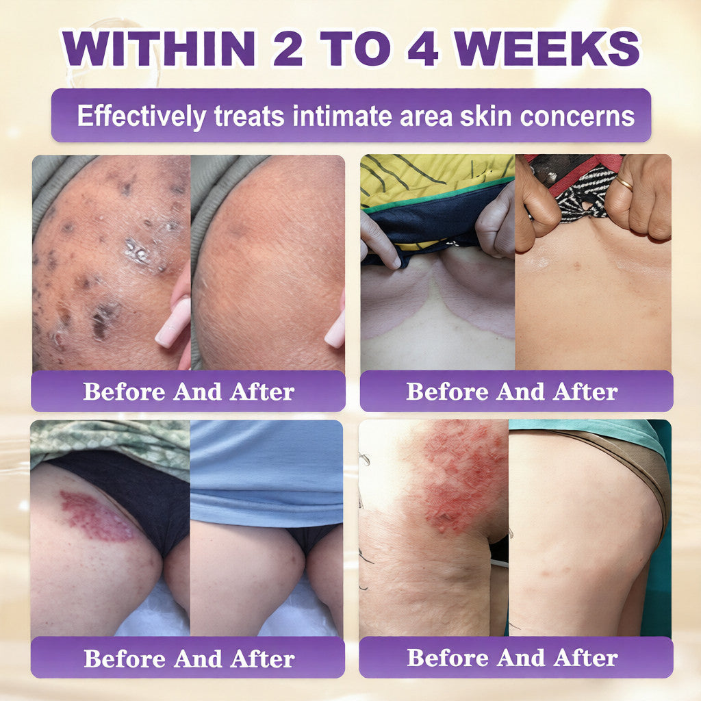 🔥LAST DAY 50% OFF - COPURELY® Biotin 10-in-1 Skin Restoration Cream
