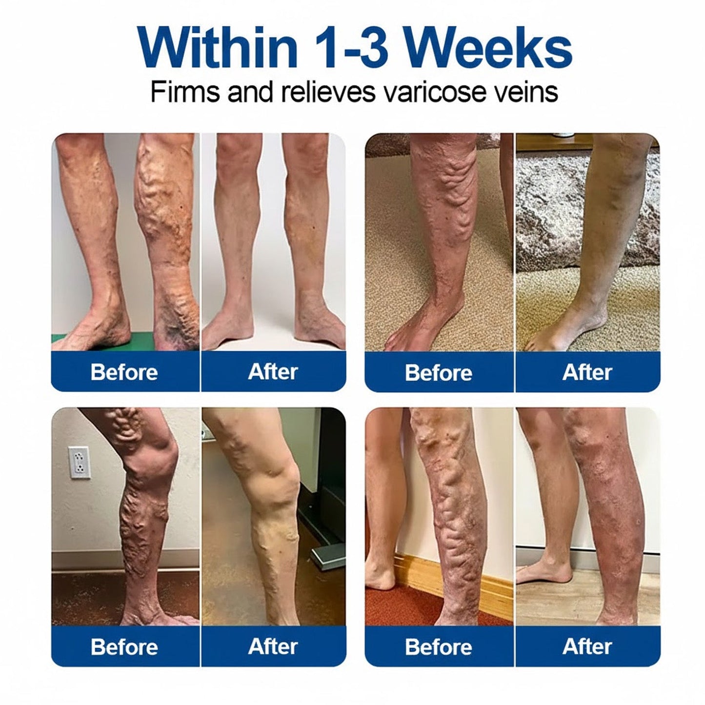 🇺🇸👨‍⚕️🔥COPURELY® VeinEase Microneedle Care Patch⚡Instant Relief, Long-Term Results