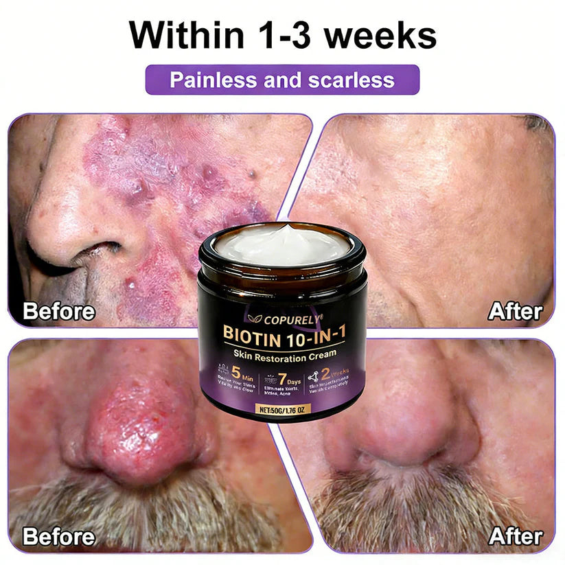 🔥LAST DAY 50% OFF - COPURELY® Biotin 10-in-1 Skin Restoration Cream