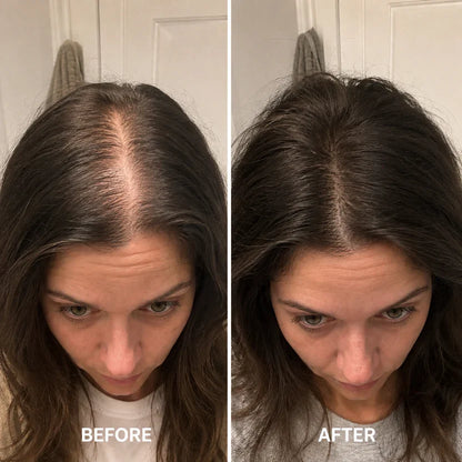 Advanced Scalp Renewal Serum — Fuller-Looking Hair Starts at the Scalp