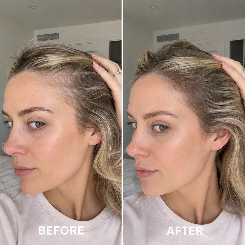 Advanced Scalp Renewal Serum — Fuller-Looking Hair Starts at the Scalp