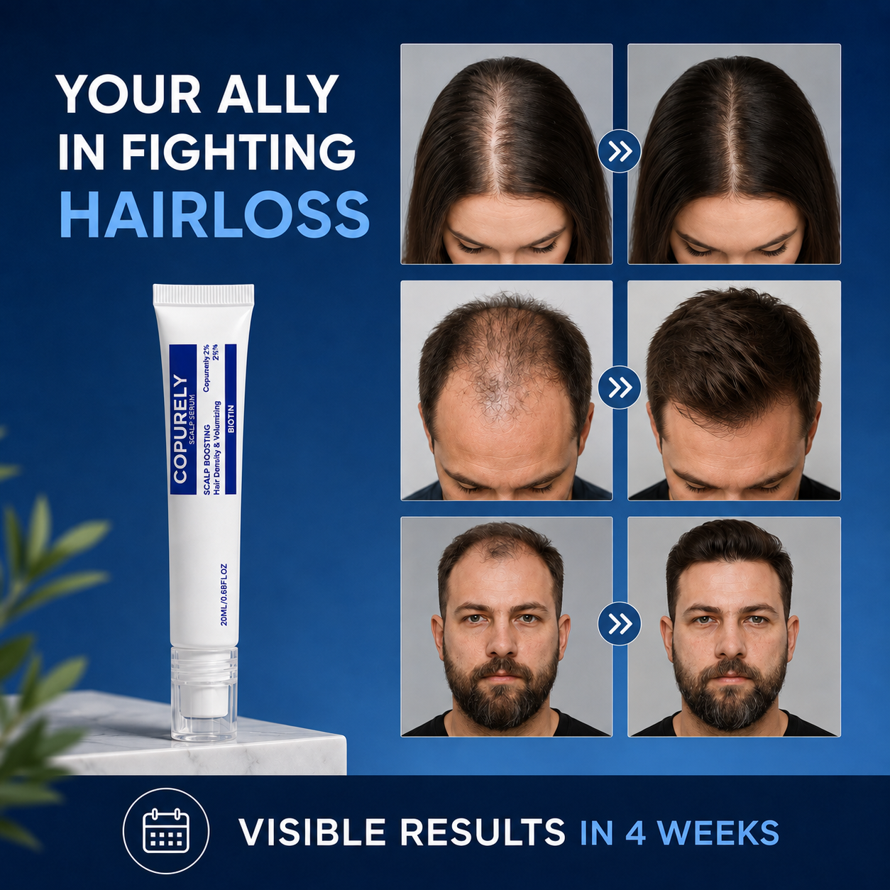 Advanced Scalp Renewal Serum — Fuller-Looking Hair Starts at the Scalp